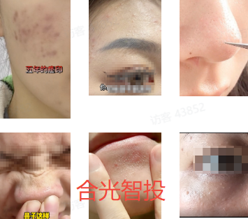 抖音广告低质案例1