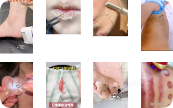 抖音广告低质案例4