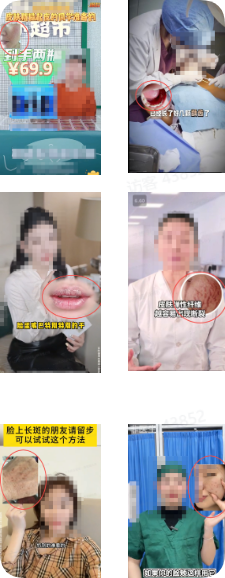 抖音广告非低质案例